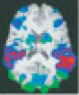 fMRI